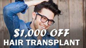 Read more about the article $1,000 OFF HAIR TRANSPLANT – May 2018