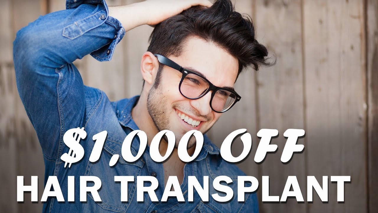 You are currently viewing $1,000 OFF HAIR TRANSPLANT – May 2018