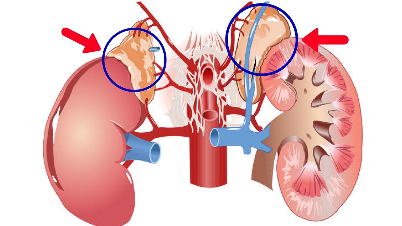 You are currently viewing 2 Main Causes Of Kidney Disease You Must Know
