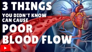→ 3 Things You Didn’t Know Can Cause Poor Blood Flow & Circulation – by Dr Sam Robbins