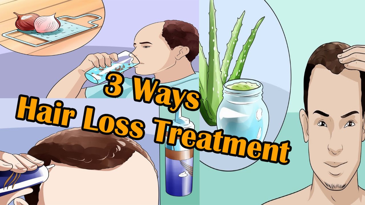 You are currently viewing 3 Ways to Hair Loss Treatment For Men I Male Pattern Hair Loss