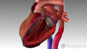 3D Medical Animation – Congestive Heart Failure
