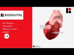 3D Medical Animation – What is a Heart Attack?