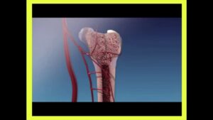 Read more about the article 6.4 Bone Formation Part 2 Endochondral Ossification
