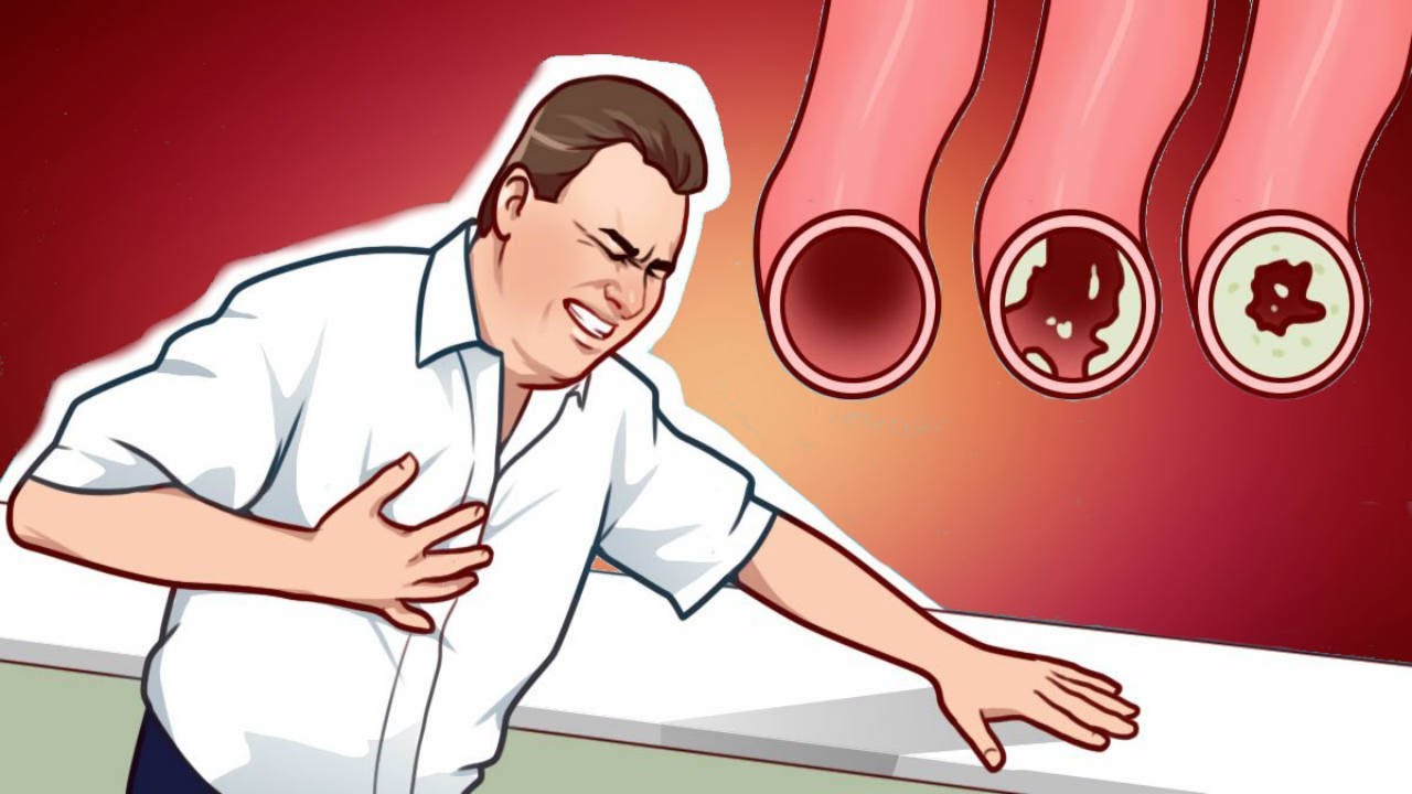 You are currently viewing 7 Lifestyle Changes That Will Clean Your Arteries Naturally And Protect You From Heart Attack
