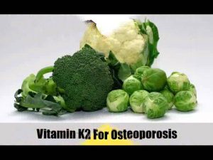 Read more about the article 7 Natural Cures For Osteoporosis