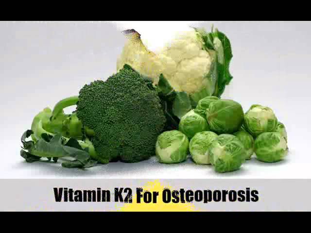 You are currently viewing 7 Natural Cures For Osteoporosis