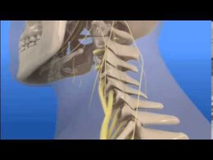 Read more about the article AUTO INJURY What Is Whiplash