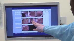 Read more about the article Gastroenterology Video – 1