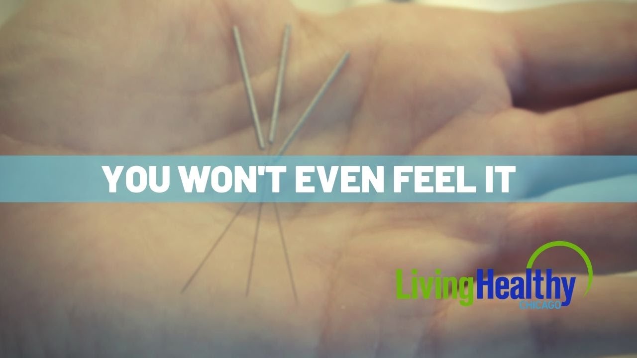 You are currently viewing Acupuncture/Acupressure Video – 1