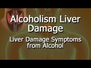 Read more about the article Alcoholism Liver Damage