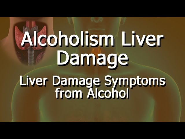 You are currently viewing Alcoholism Liver Damage