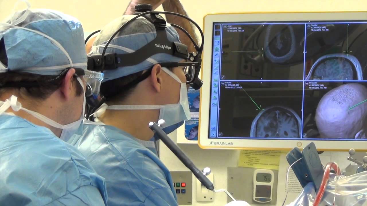 You are currently viewing Neuro Surgery Video – 5