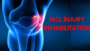 Read more about the article BEST EXERCISES FOR MCL INJURY REHABALITATION