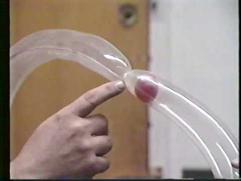 You are currently viewing Balloon Angioplasty and Heart Disease:  Demo Using Balloons
