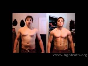 Read more about the article Before and after using the HGH