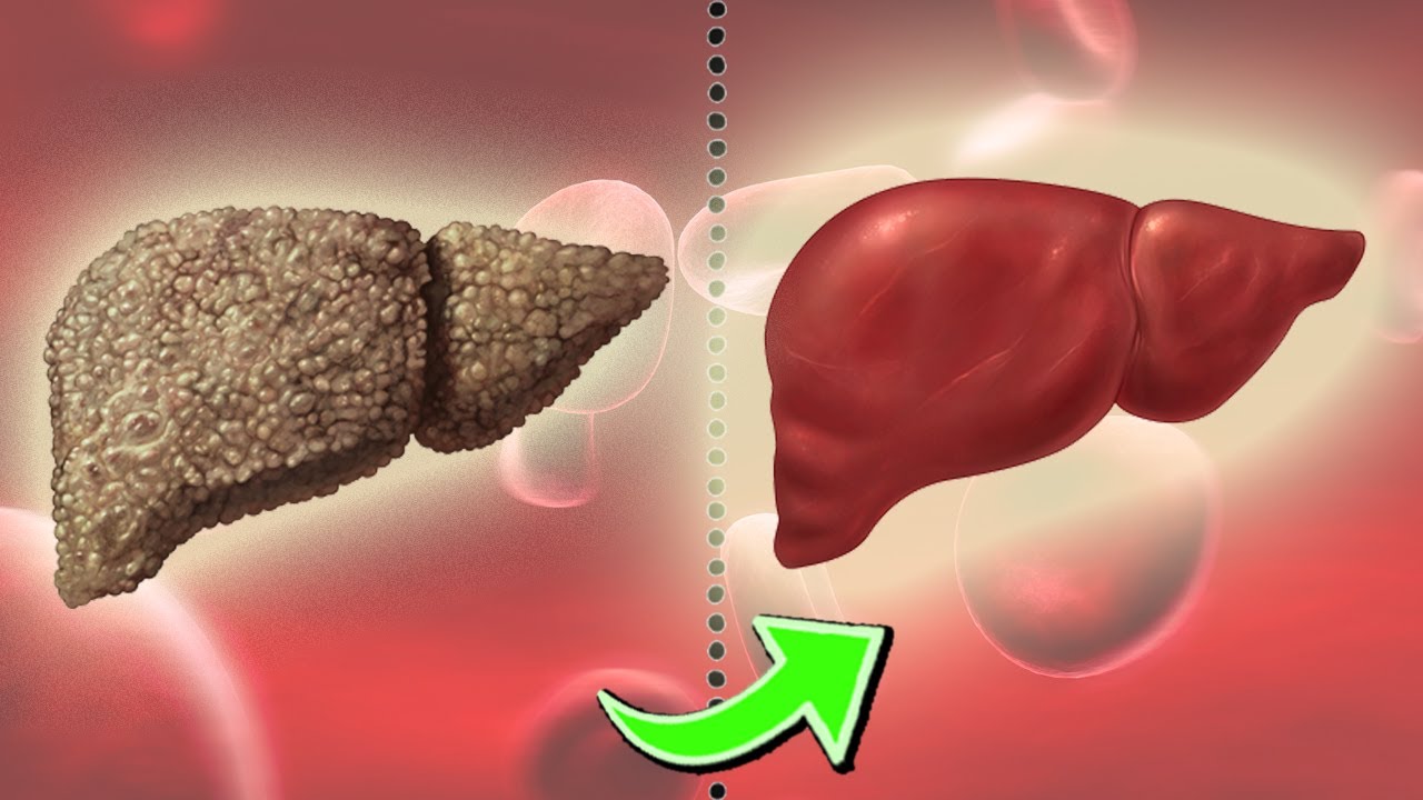 You are currently viewing Best Foods for Liver Repair & Foods to Avoid For Healthy Liver