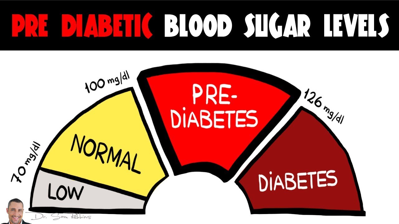 You are currently viewing Blood Sugar Health Tips – Pre Diabetic Blood Sugar Levels! – by Dr Sam Robbins