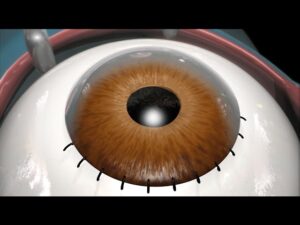 Laser Surgeries Video – 2