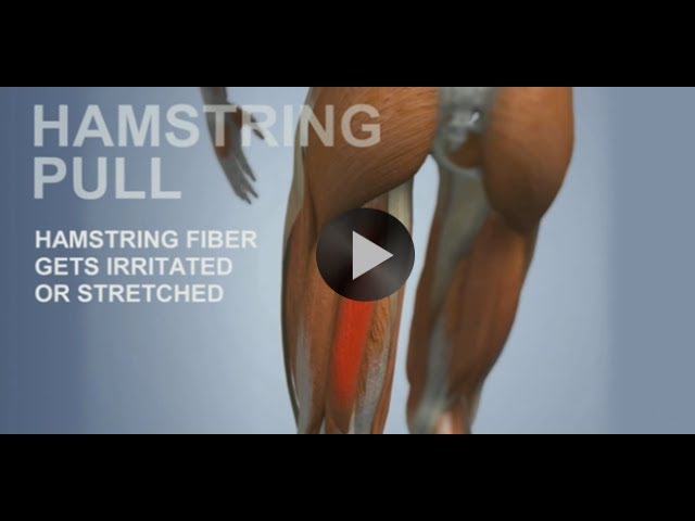 You are currently viewing Common Sports Injuries: Hamstring Pull