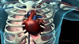 Coronary Heart Disease Animation