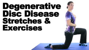 Read more about the article Degenerative Disc Disease (DDD) Stretches & Exercises – Ask Doctor Jo