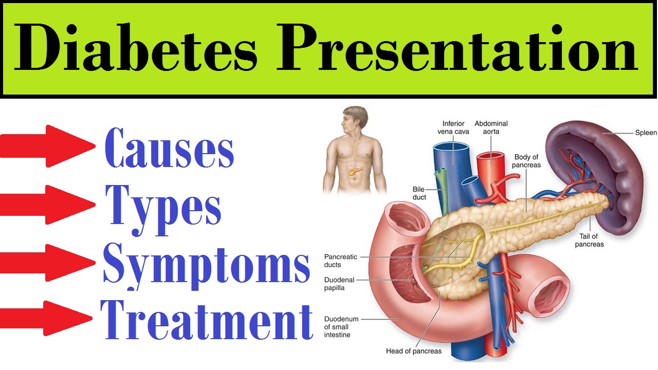 You are currently viewing Diabetes  :- Causes,Types & Treatment ! (Award Wining Presentation)