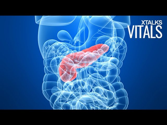 You are currently viewing Diabetes Drug Metformin Could Inhibit Progression of Pancreatic Cancer