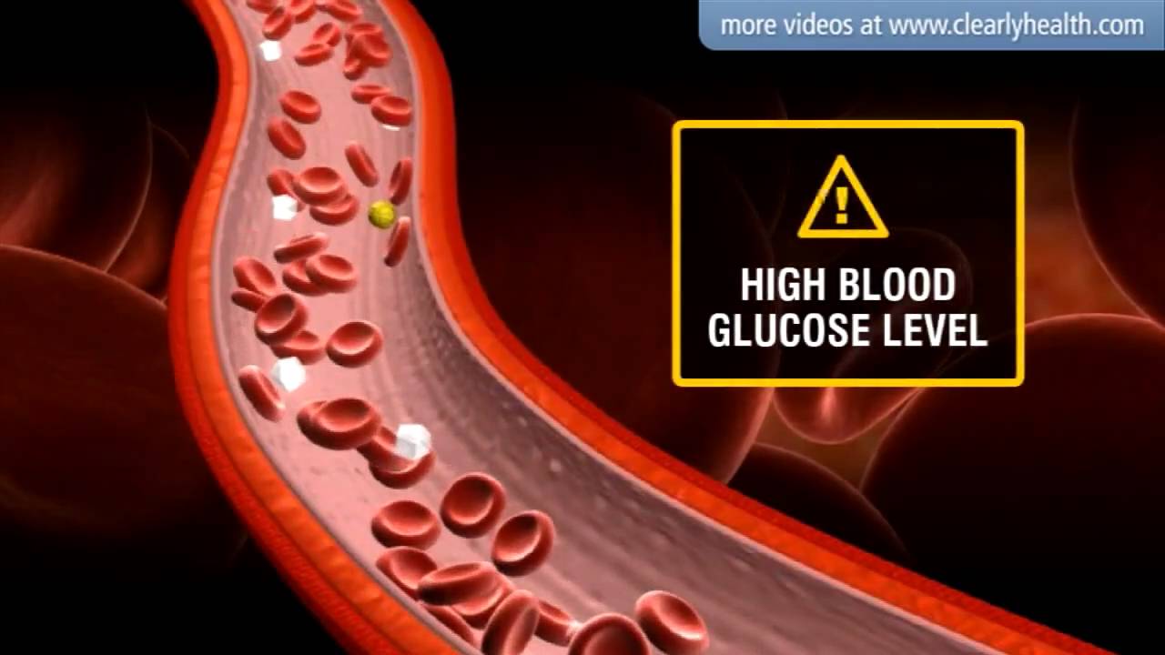 You are currently viewing Diabetes: Insulin’s side effects