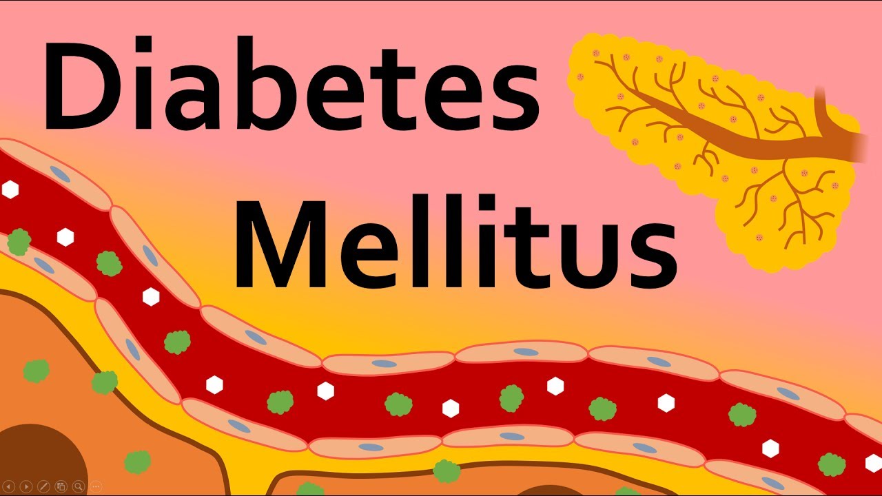 You are currently viewing Diabetes Mellitus and Insulin