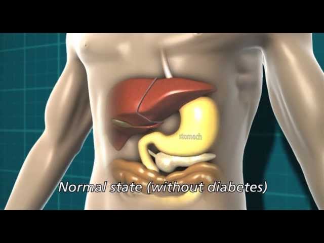 You are currently viewing Diabetes and the body | Diabetes UK
