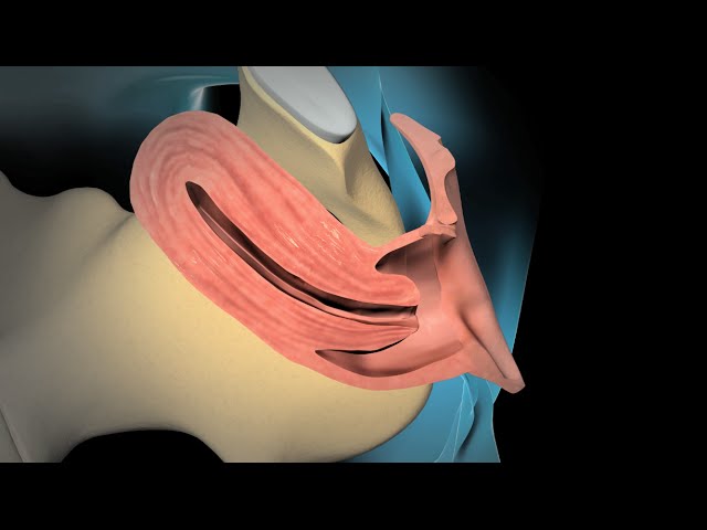 You are currently viewing Obstrics Surgeries Video – 5