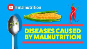 Diseases Caused by Malnutrition – SCURVY, RICKETS, BERIBERI, PELLAGRA