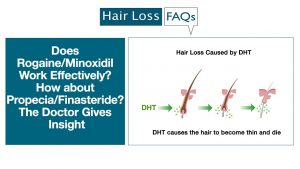 Does Rogaine/Minoxidil Work Effectively? How about Propecia/Finasteride?