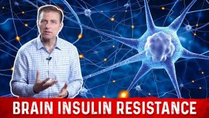 Read more about the article Dr. Berg Explains Brain Insulin Resistance
