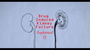 Read more about the article Drug Induced Renal Failure – Causes, Symptoms & Stages [Doctor Interview]
