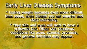 Read more about the article Early Liver Disease Symptoms