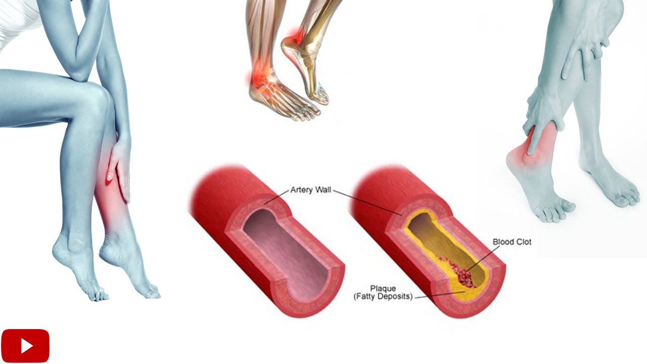 You are currently viewing Exercises For Improving Blood Circulation In Legs – by Dr Sam Robbins
