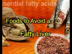 Foods to Avoid a Fatty Liver
