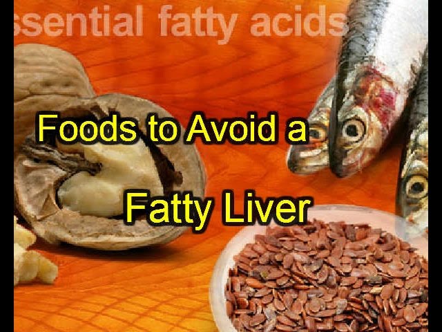 You are currently viewing Foods to Avoid a Fatty Liver
