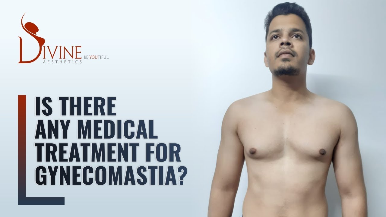 You are currently viewing Gynecomastia Treatment – Is There Any Medical Treatment?