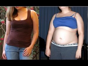 HUGE Weight Gain of 70 LBS – Before & After