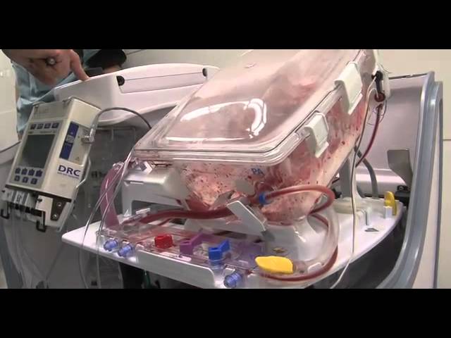You are currently viewing Organ Transplantation Surgeries Video – 2
