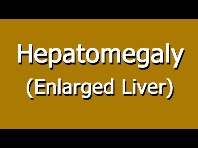 You are currently viewing Hepatomegaly  – Enlarged Liver Causes, Symptoms, And Diagnosis