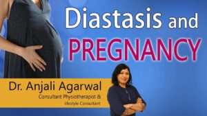 Physiotherapy in Obstetrics Video – 11