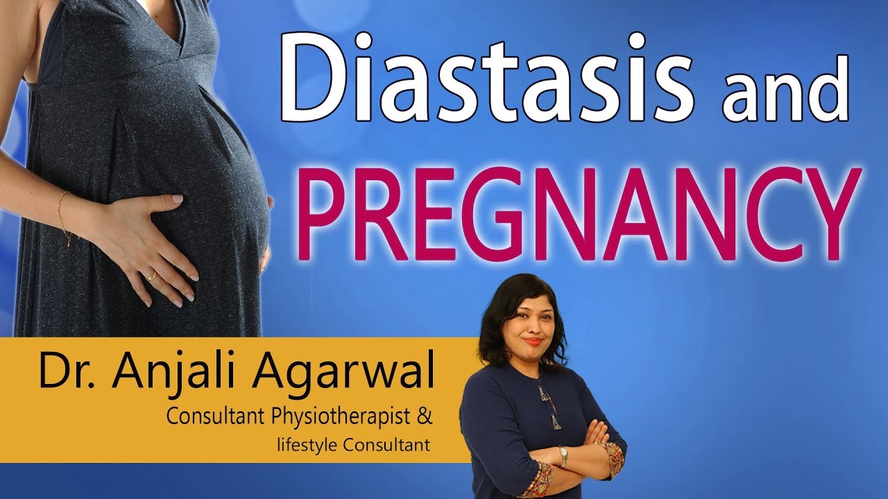 You are currently viewing Physiotherapy in Obstetrics Video – 11