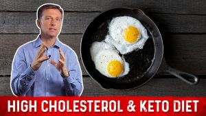 Read more about the article High Cholesterol on a Ketogenic diet? | Dr.Berg on Keto and Cholesterol