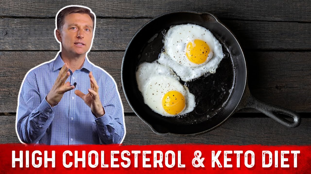 You are currently viewing High Cholesterol on a Ketogenic diet? | Dr.Berg on Keto and Cholesterol