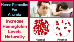 Read more about the article Home Remedies To Cure ANEMIA  Fast – Treat Iron Deficiency Anemia Naturally | Best Foods For Anemia