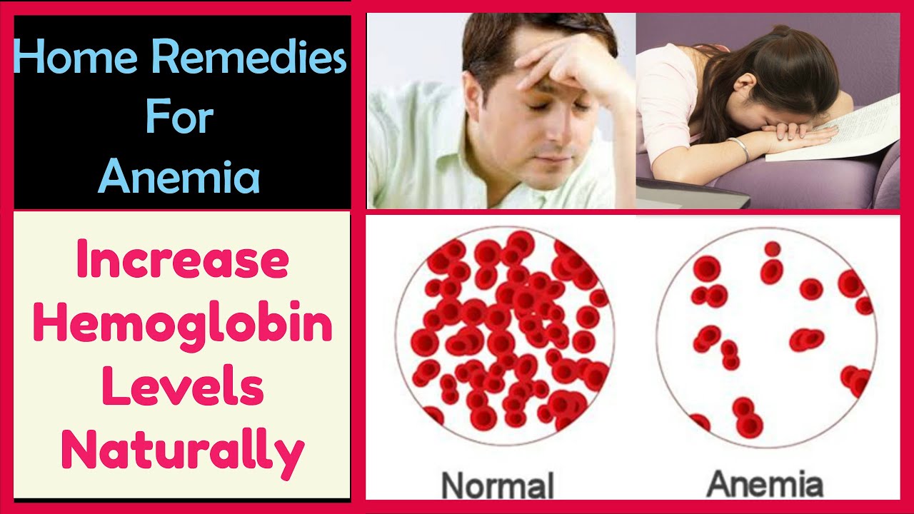 You are currently viewing Home Remedies To Cure ANEMIA  Fast – Treat Iron Deficiency Anemia Naturally | Best Foods For Anemia